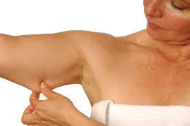 flacidez_brazo
