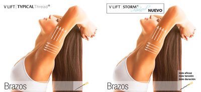 hilos magicos brazos brazos