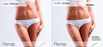 Hilos mágicos piernas piernas
