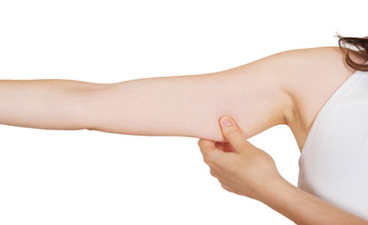 Brazo mujer con brazos flacidos