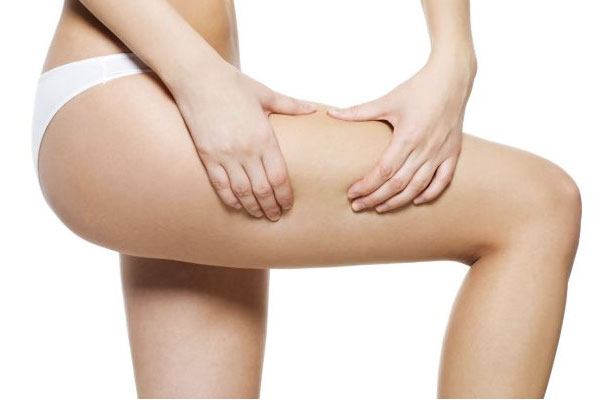 celulitis-slide