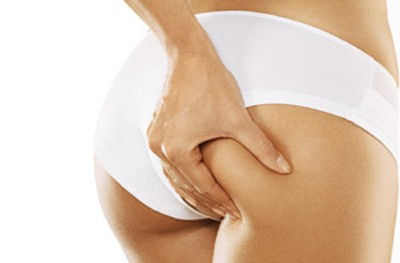 Chica apretando piel del gluteo. celulitis