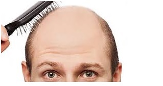 Alopecia y las células madre