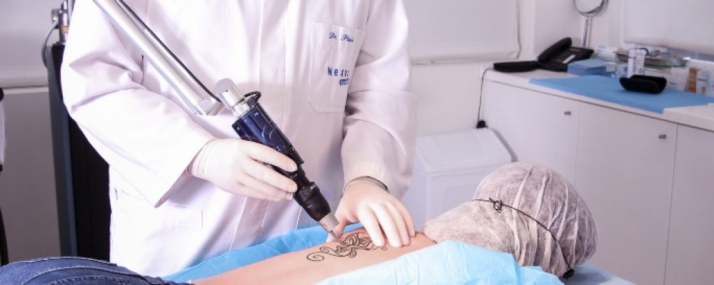 PicoSure: la nueva era para la eliminación de los tatuajes