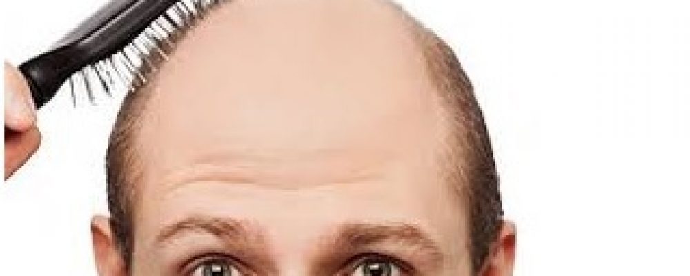 Alopecia y las células madre